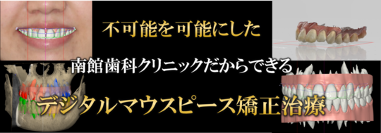 山形のマウスピース矯正「インビザライン」専門サイト - 南館歯科クリニック