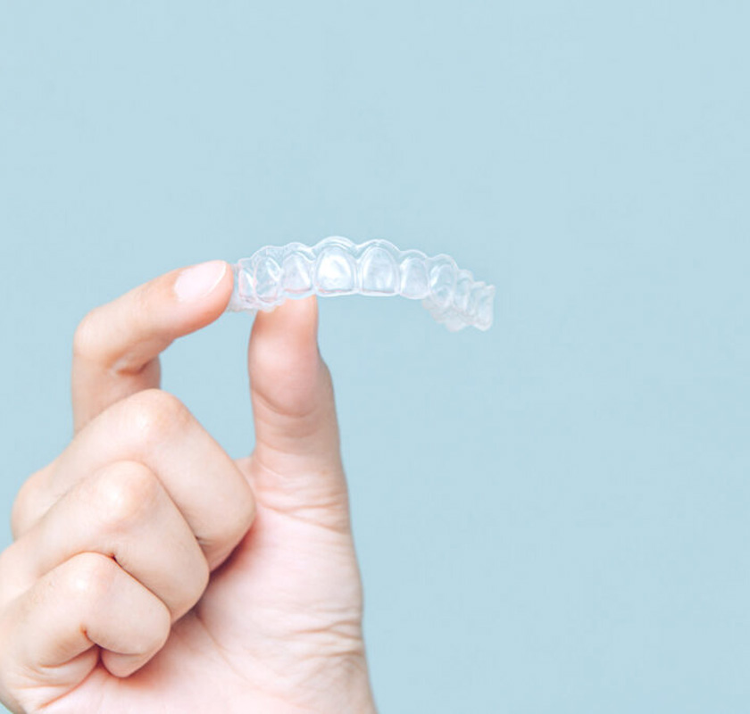 「インハウスアライナー矯正」も好評です