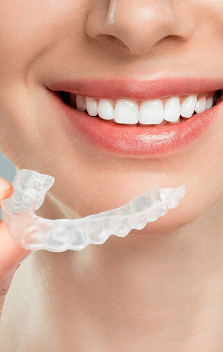 南舘歯科クリニック・矯正歯科のマウスピース矯正（インビザライン）