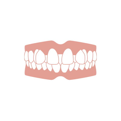 歯の間に隙間がある