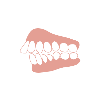 前歯が出ている