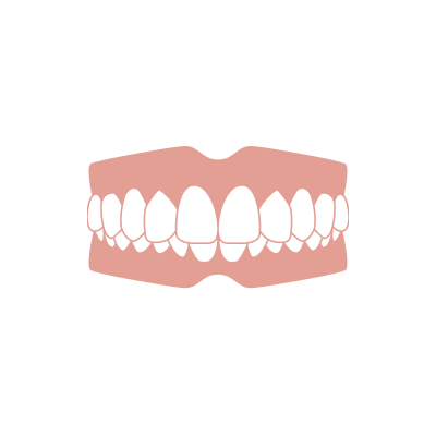 噛み合わせが深い